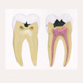 Dental Study Model  ġ ġ 